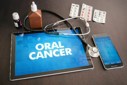 oral cancer on tablet and iphone showing diagnosis