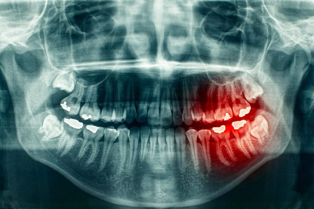 Dental Malpractice Case